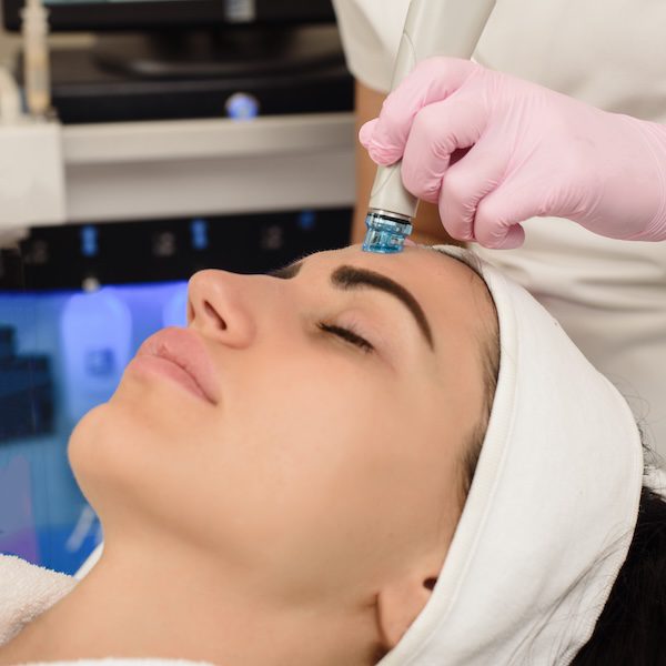 Ultrasound face peeling