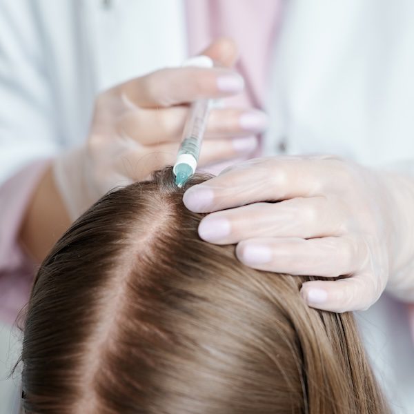 Trichologist makes an injection in the scalp, head skin for hair treatment. Beautician and the patient in the clinic of aesthetic medicine.Healthy strong hair concept.