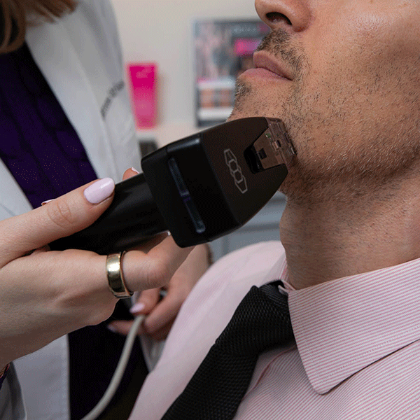 laser-treatments-idrirss